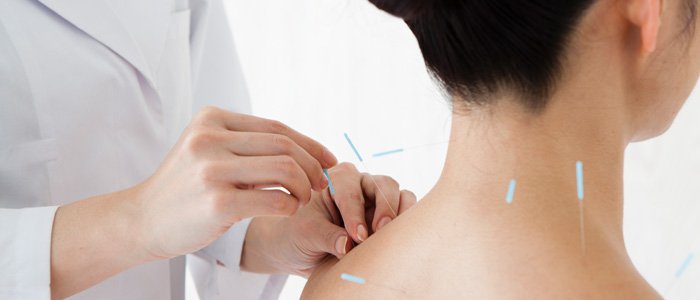 a female patient receiving acupuncture treatment